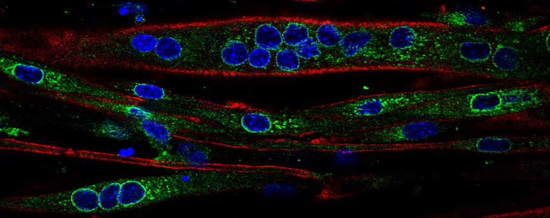 Muscle cells